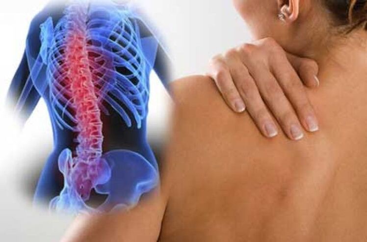 Bij osteochondrose kan pijn uitstralen naar verre delen van het lichaam