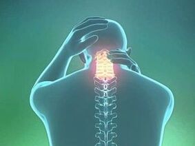 Een symptoom van cervicale osteochondrose is hoofdpijn