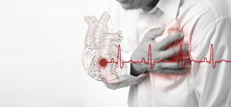 hartaanval als oorzaak van pijn onder het linker schouderblad