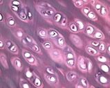 Gewricht onder een microscoop