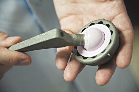 Chirurgie voor artrose