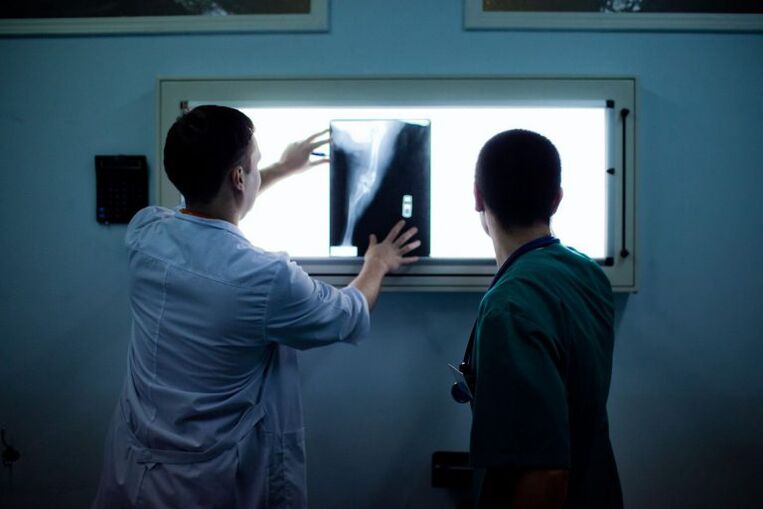 Diagnose van artrose op X -RAY