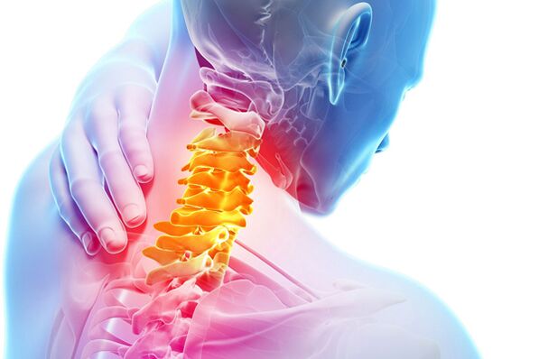 Cervicale osteochondrose