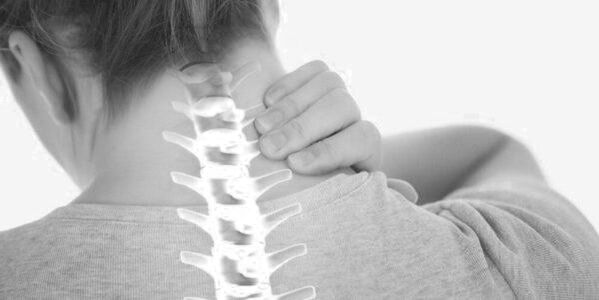 Osteochondrose van de cervicale wervelkolom - pathologie van het bewegingsapparaat