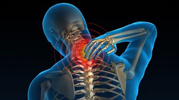 Pijn bij het draaien van de nek kan wijzen op het vertebrale cervicale osteochondrosesyndroom